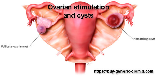 Ovarian stimulation and cysts