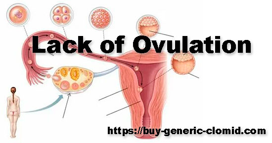 women lack of ovulation